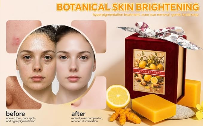 Natural Turmeric & Lemon Soap for Even Skin Tone, Acne-Prone Skin Care,Handmade, Luxury Bath & Shower Gift,gentle effective, plant-based cold processed natural soap gift set (2 pack)