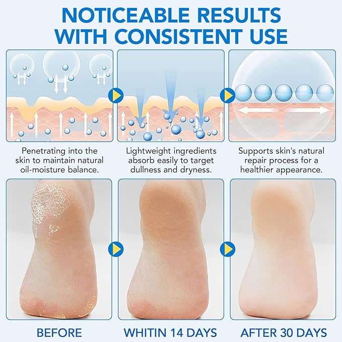 Urea Foot Care Stick, 2pcs 60% Urea with 2% Salicylic Acid Foot Cream Moisturizer for Dry Cracked Feet, Knees, Elbows, Hands, Moisturizes and Hydrates the Dry Skin, Callus Remover & Skin Softener