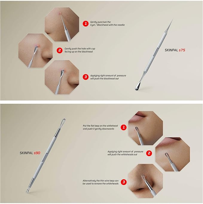 Suvorna Pimple Popper Tool Kit | Milia Remover | Lancets for Facial Extraction | White head Extractor Tool for Face | Comedone Extractor | Blackhead Remover tool | Acne Needle Tool & Cyst Removal Tool