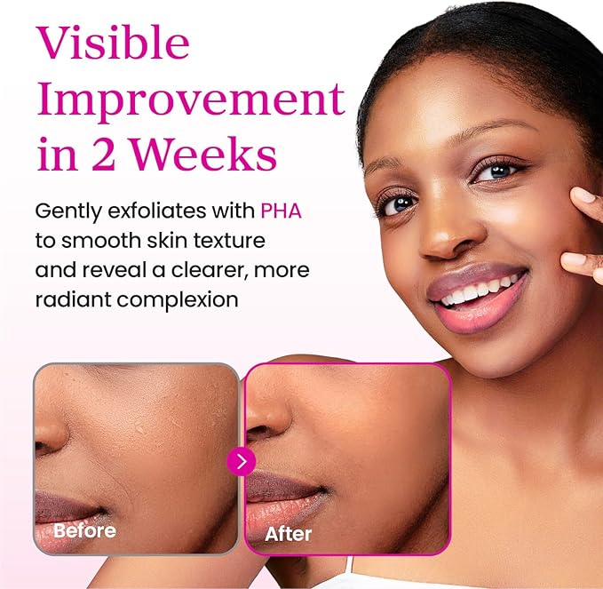 YADAH Collagen Hydra Essence – Deep Hydration, Soothing with 80,000ppm Collagen peptides and Triple Hyaluronic Acid, Centella Asiatica Extract, Niacinamide – 5.07 fl oz