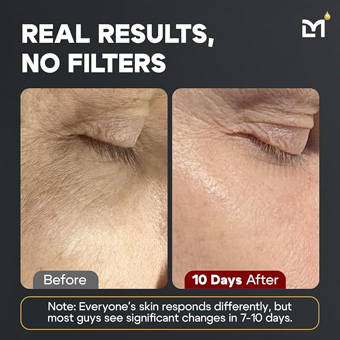 Titan Sports Anti-Aging Mens Skin Care Kit – Cleanser, Face Serum, Eye Cream, Face Moisturizer – Men, Skin Care Set – Dark Circles, Wrinkles, Fine Lines – Vitamin C, Niacinamide, HA–Unscented