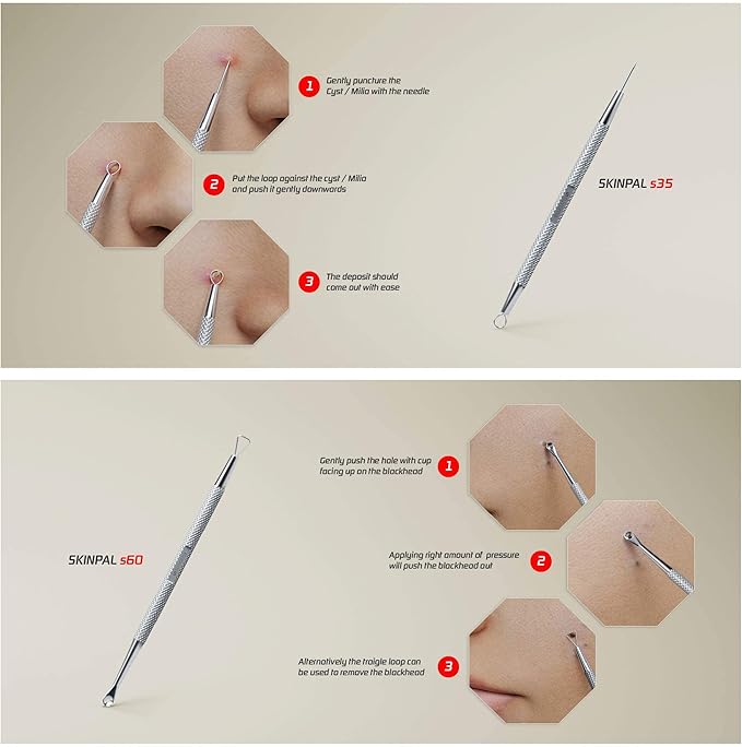 Suvorna Pimple Popper Tool Kit | Milia Remover | Lancets for Facial Extraction | White head Extractor Tool for Face | Comedone Extractor | Blackhead Remover tool | Acne Needle Tool & Cyst Removal Tool