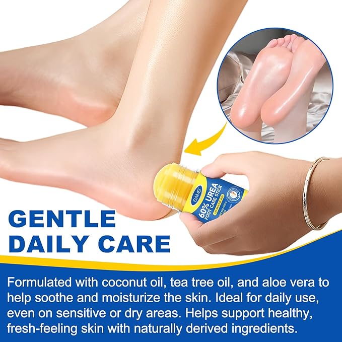 60% Urea Cream with 2% Salicylic Acid, Foot Repair Stick – Deep Moisturizing Callus Remover for Cracked Heels, Dry Feet, Elbows, and Hands – Non-Greasy, Hygienic Solid Stick