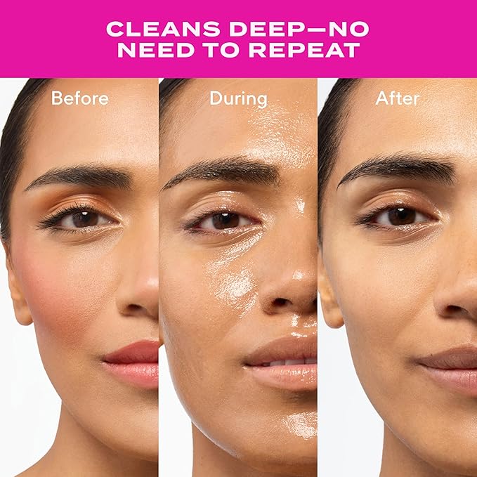 Murad Lipid-Enriched Double Cleansing Balm - Hydrating Balm-to-Oil Face Cleanser & Makeup Remover Removes Long-Wear Makeup & SPF Barrier Repair with Ceramides & Camellia Oil 1.7 Fl Oz