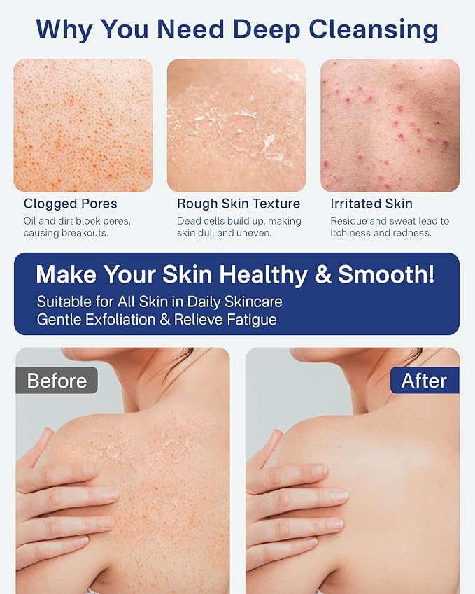 Yiclick Heavy Exfoliating Gloves Mitts, Exfoliating Body Scrubber Exfoliator For Shower Bath, Korean Body Scrub Mitts for Dead Skin Remover, Loofah Luffa Sponge Wash Cloth For Men Women