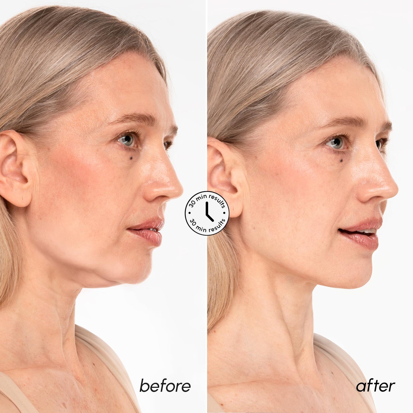 V Line Lifting Face Mask with Collagen and Gold