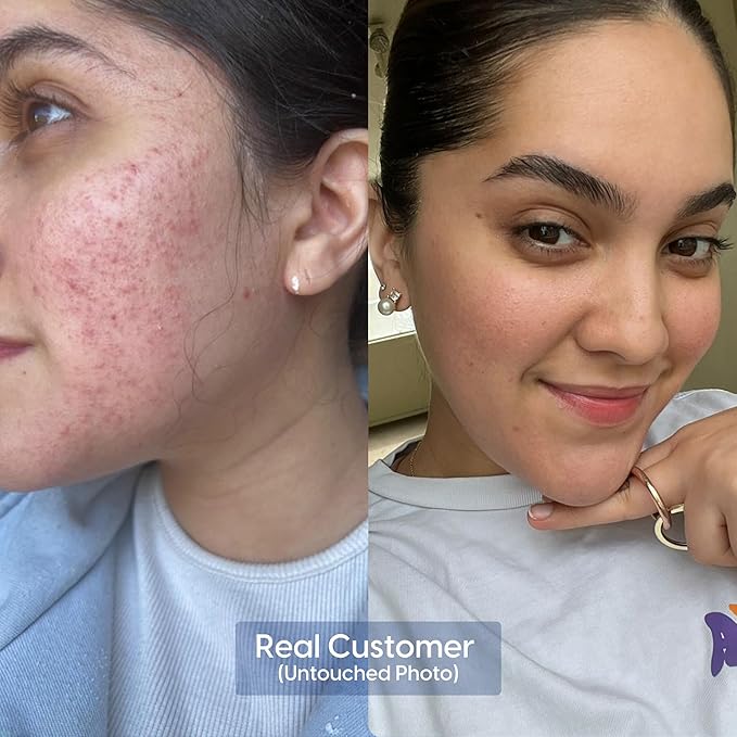 Strive Apex Skin Care Set - Advanced Anti Aging - Fragrance Free, All Skin Types, Fights Dark Circles Dull Skin - Peptides, Retinal, Vitamin C, Niacinamide (Face Wash, Scrub, Moisturizer, Serum)