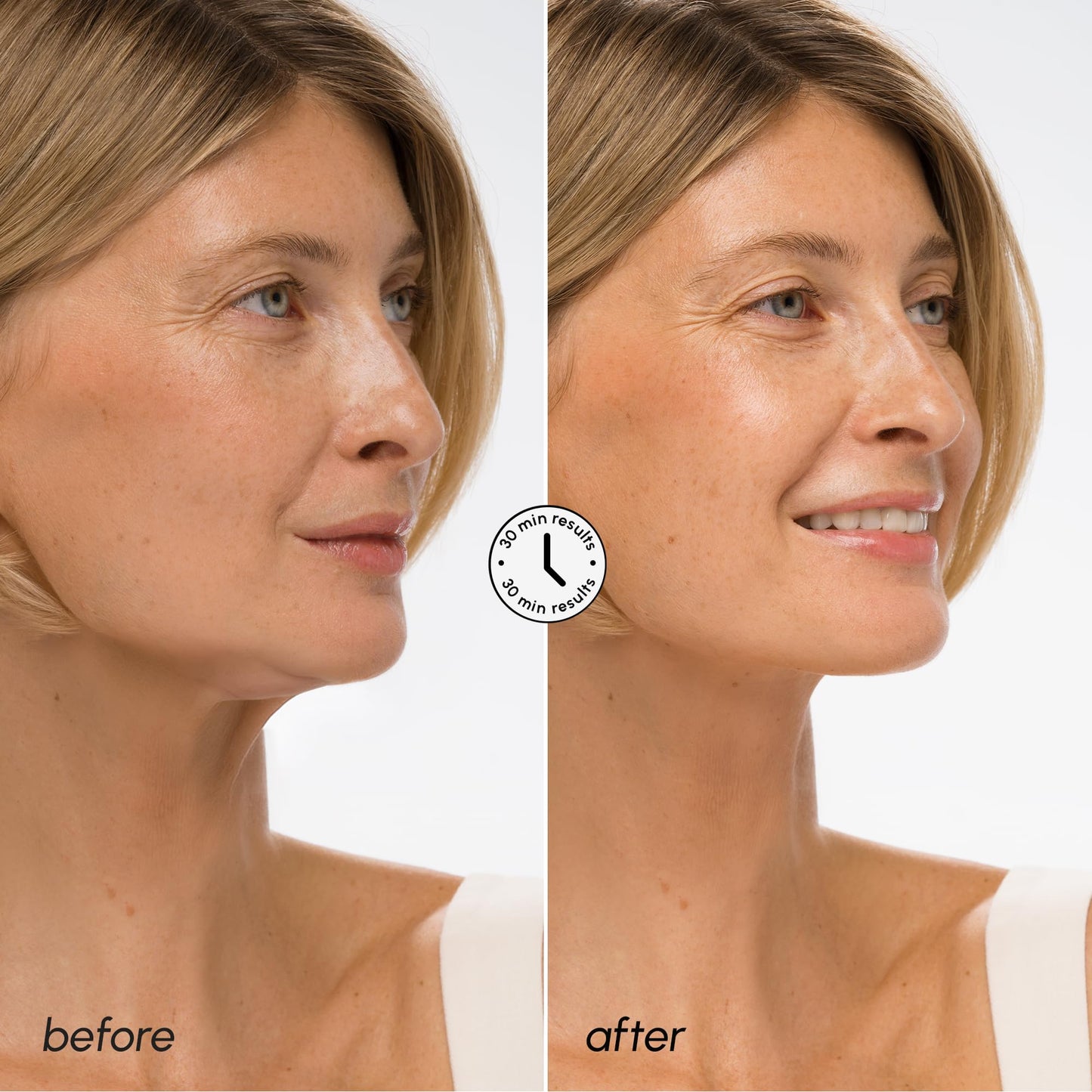 V Line Lifting Face Mask with Collagen and Gold