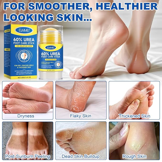 60% Urea Cream with 2% Salicylic Acid, Foot Repair Stick – Deep Moisturizing Callus Remover for Cracked Heels, Dry Feet, Elbows, and Hands – Non-Greasy, Hygienic Solid Stick (2pcs)